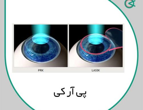 پی آر کی | برای چه کسانی مناسب تر است ؟