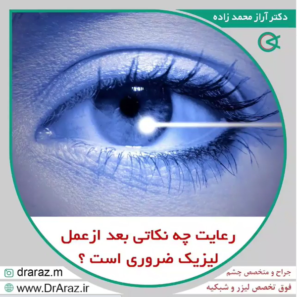 لیزیک - دکتر آراز محمدزاده