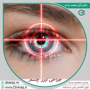 جراحی لیزر چشم