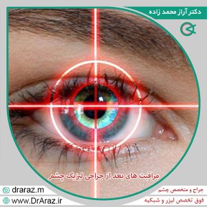 مراقبت های بعد از جراحی لیزیک چشم