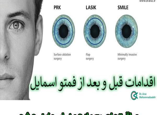 اقدامات قبل و بعد فمتو اسمایل - دکتر آراز محمدزاده