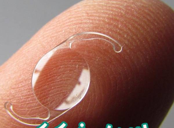 لنزهای فیکیک - دکتر آراز محمدزاده