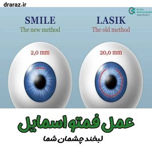 عمل فمتواسمایل - دکتر آراز محمدزاده