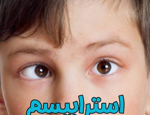 استرابیسم چیست ؟