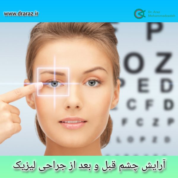 آرایش چشم قبل و بعد از جراحی لیزیک - ذکتر آراز محمدزاده