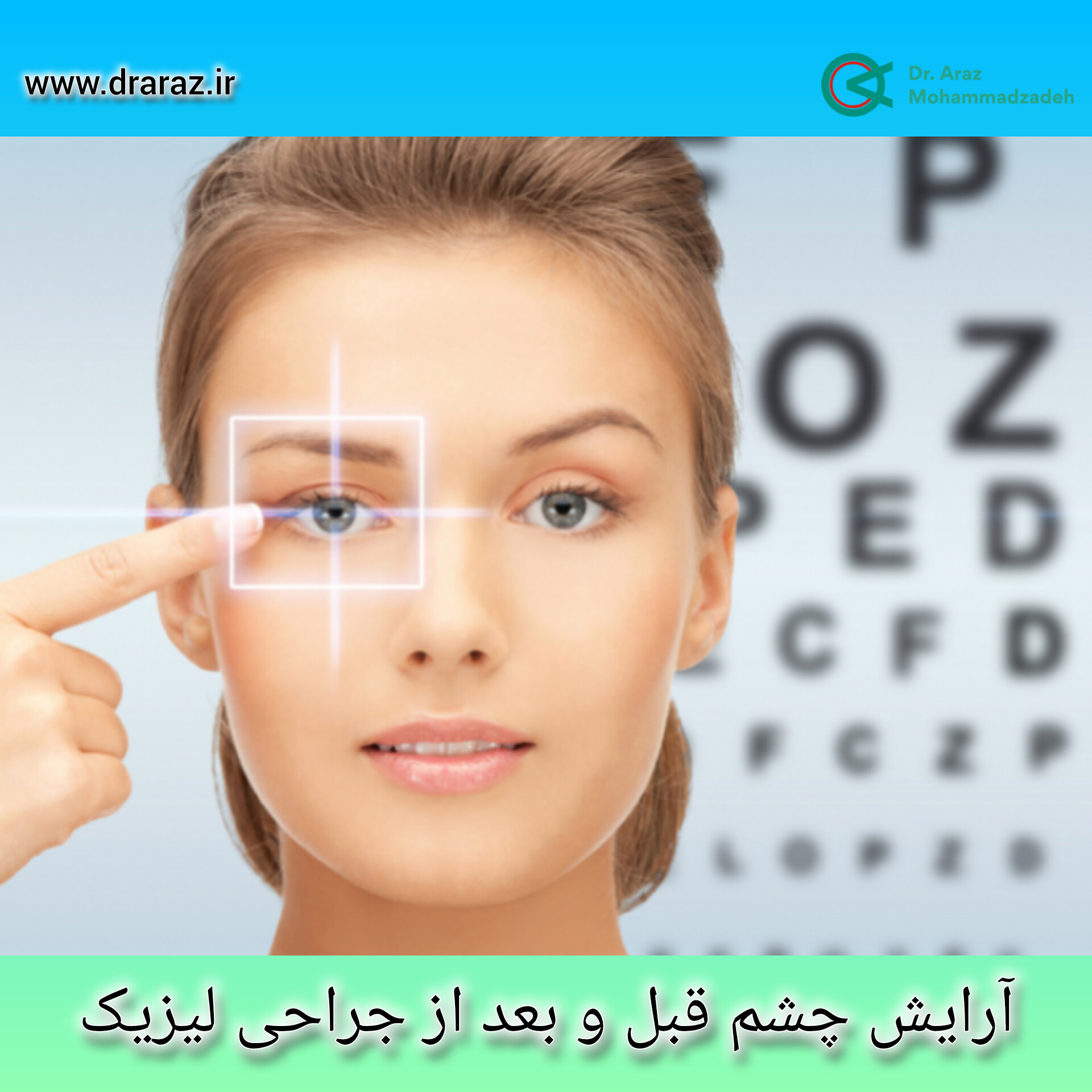 آرایش چشم قبل و بعد از جراحی لیزیک - ذکتر آراز محمدزاده