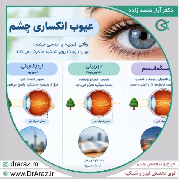 اصلاح عیوب انکساری