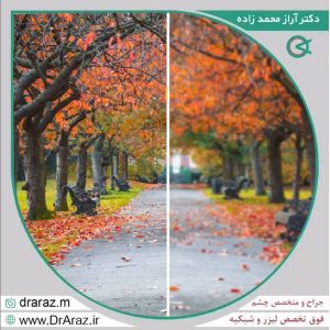 آستیگماتیسم