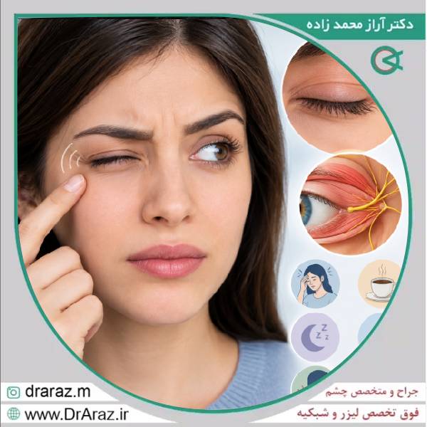 پرش چشم