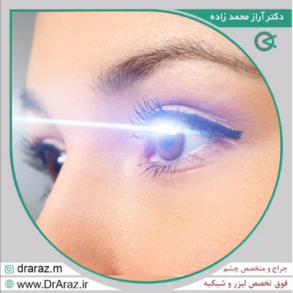 کاشت مژه بعد از لیزیک و لازک