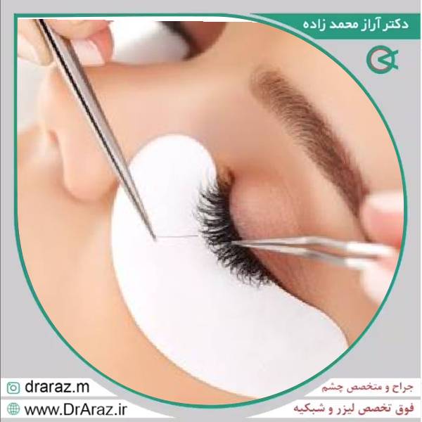 کاشت مژه بعد از جراحی عیوب انکساری